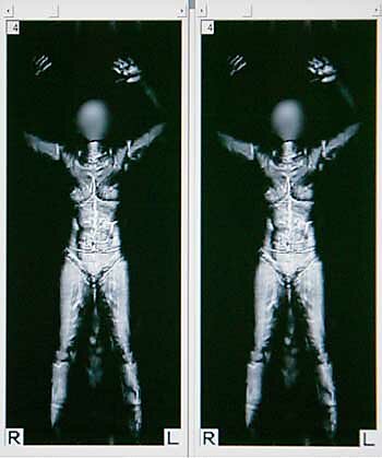 Media Name: strip-search_machine.jpg